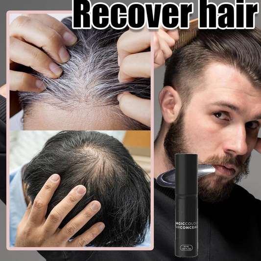 💥Scalp Concealer for fuller, natural-looking hair